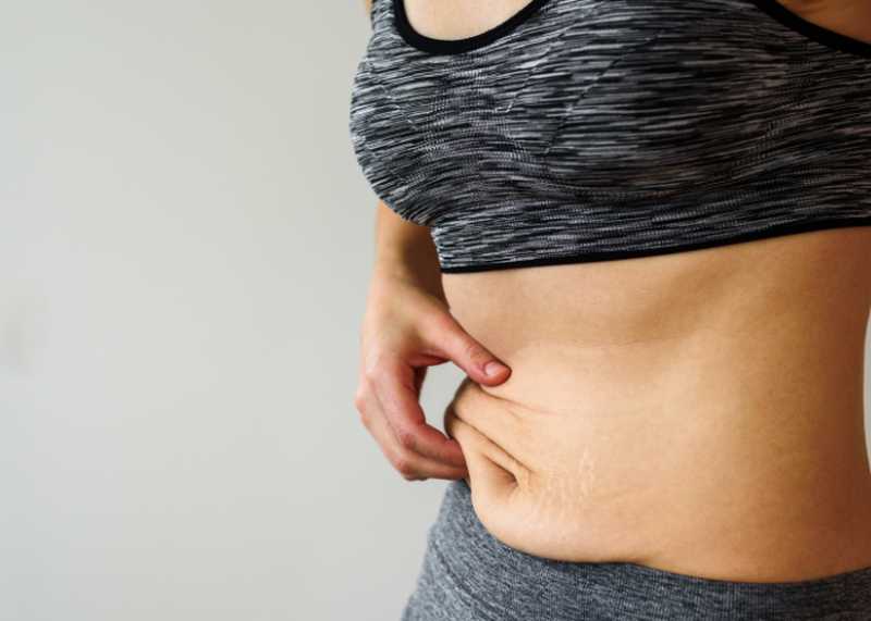 How to Get Rid of a Hanging Belly post-C-Section - Exercises & Lifestyle  Changes - Medicszone